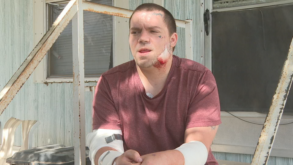 Man who jumped in to save neighbor’s lives during dog attack describes incident